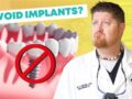 The Top Reasons You Should NOT Get Dental Implants