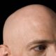 Dream Meaning of Being Bald