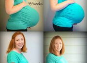 Dream Meaning of Pregnancy Twins