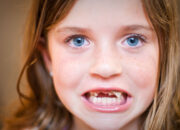 Dream Meaning of A Loose Tooth