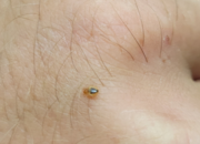 Dream Meaning of Bugs Crawling On Me