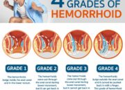 Dream Meaning of Hemorrhoids