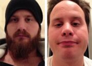 Dream Meaning of Husband No Longer Having His Beard