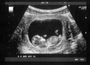 Dream Meaning of Seeing A Baby
