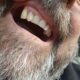 Dream Meaning of All My Teeth Falling Out