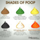 Dream Meaning of Green Stool