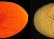 Dream Meaning of Seeing Eggs