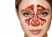 Dream Meaning of Sinus