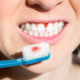 Dream Meaning of Tooth Bleeding