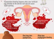 Dream Meaning of Being Pregnant And Bleeding