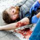 Dream Meaning of Someone Bleeding