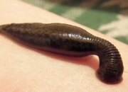 Dream Meaning of Leech