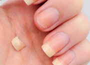 Dream Meaning of Broken Nail