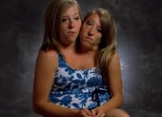 Dream Meaning of Siamese Twins