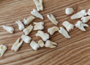 Dream Meaning of Tooth Falling Out