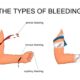 Dream Meaning of Seeing Someone Bleeding