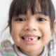 Dream Meaning of Milk Teeth