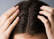 Dream Meaning of Dandruff