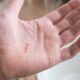 Dream Meaning of Cutting Out The Palm Of Left Hand