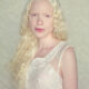 Dream Meaning of Seeing An Albino