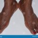 Dream Meaning of Black Feet