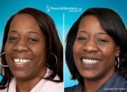 Dream Meaning of Teeth Fixing