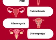 Dream Meaning of Heavy Period