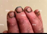 Dream Meaning of Dirty Fingernails