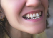 Dream Meaning of Crooked Teeth