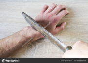 Dream Meaning of Hand Cut Off