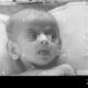 Dream Meaning of A Malnourished Baby