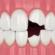 Dream Meaning of Sharp Teeth