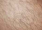 Dream Meaning of A Hairy Body