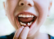 Dream Meaning of Teeth Falling Out