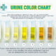Dream Meaning of Urine