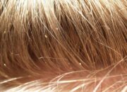 Dream Meaning of Lice In Someone’s Hair