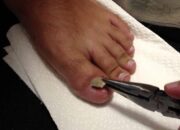 Dream Meaning of Pulling Toenails