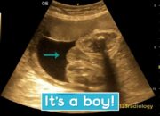 Dream Meaning of Seeing A Baby Boy