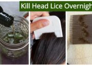 Dream Meaning of Killing Head Lice