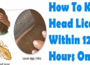 Dream Meaning of Killing Lice
