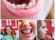 Dream Meaning of A Tooth Falling Out