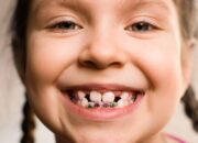 Dream Meaning of Loosing Teeth