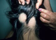 Dream Meaning of Having Bald Spots