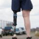 Dream Meaning of A Prosthetic Leg