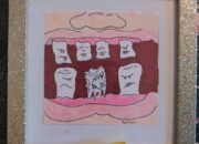 Dream Meaning of A Rotten Tooth