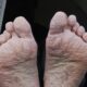 Dream Meaning of Wet Feet