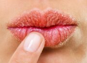 Dream Meaning of Dry Lips
