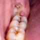 Dream Meaning of Red Cricket Coming Out Of My Mouth