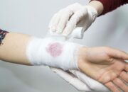 Dream Meaning of Bleeding