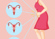 Dream Meaning of Having Menstruation